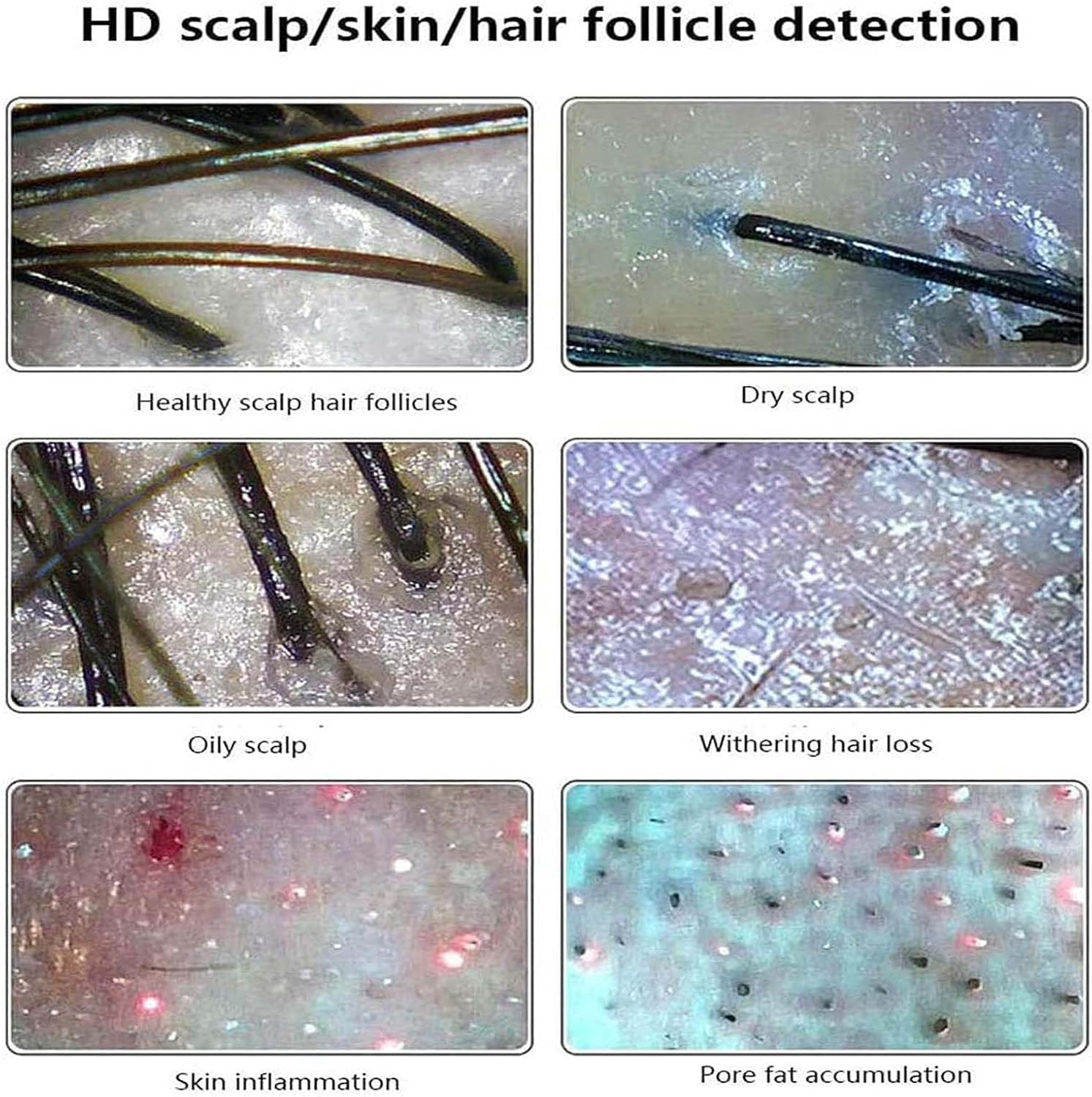 Skin Diagnosis Hair Analyzer Machine,50x/200x Skin Hair Scalp Detector,11-Inch Hd Display-10 Million Pixels,for Facial,Hairdressing,Scalp Care,Home,Beauty Salon