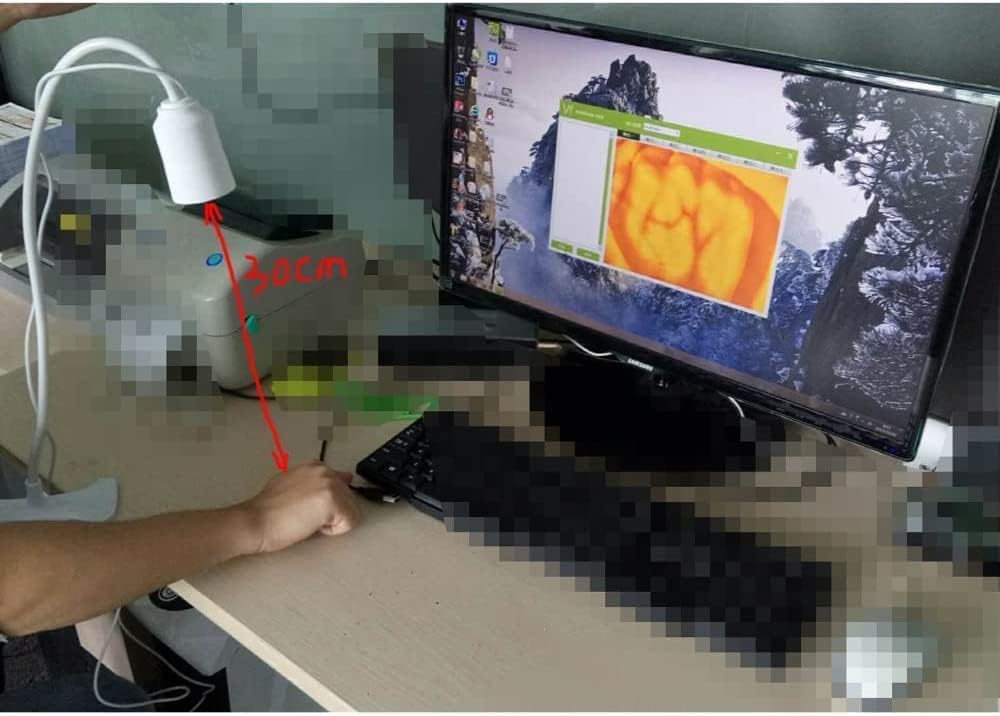 Adults Children Suitable Vein Viewer Display Lights Imaging Find Vein Medical Vein Finder Vein Viewer, for Hospitals