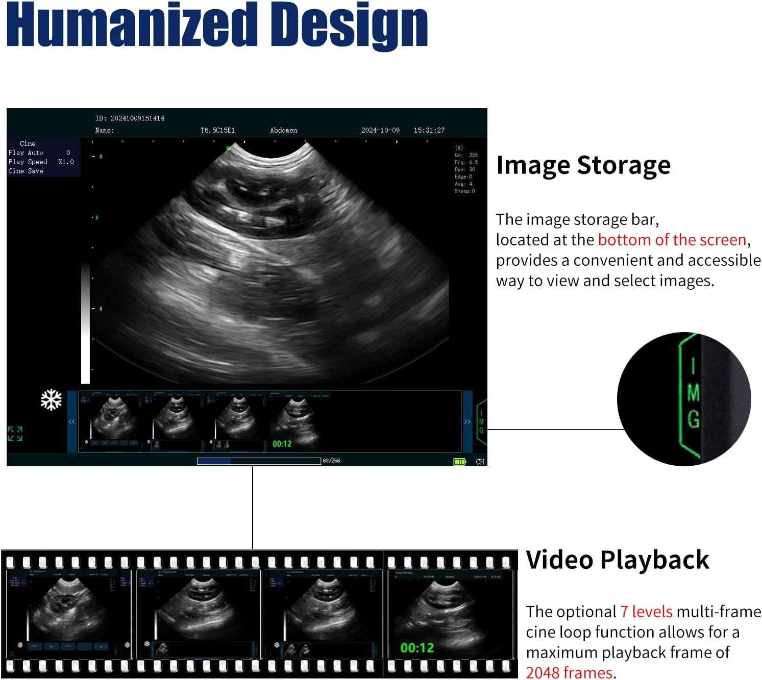 N60 Ultrasound Machine, PW upgradable, 15
