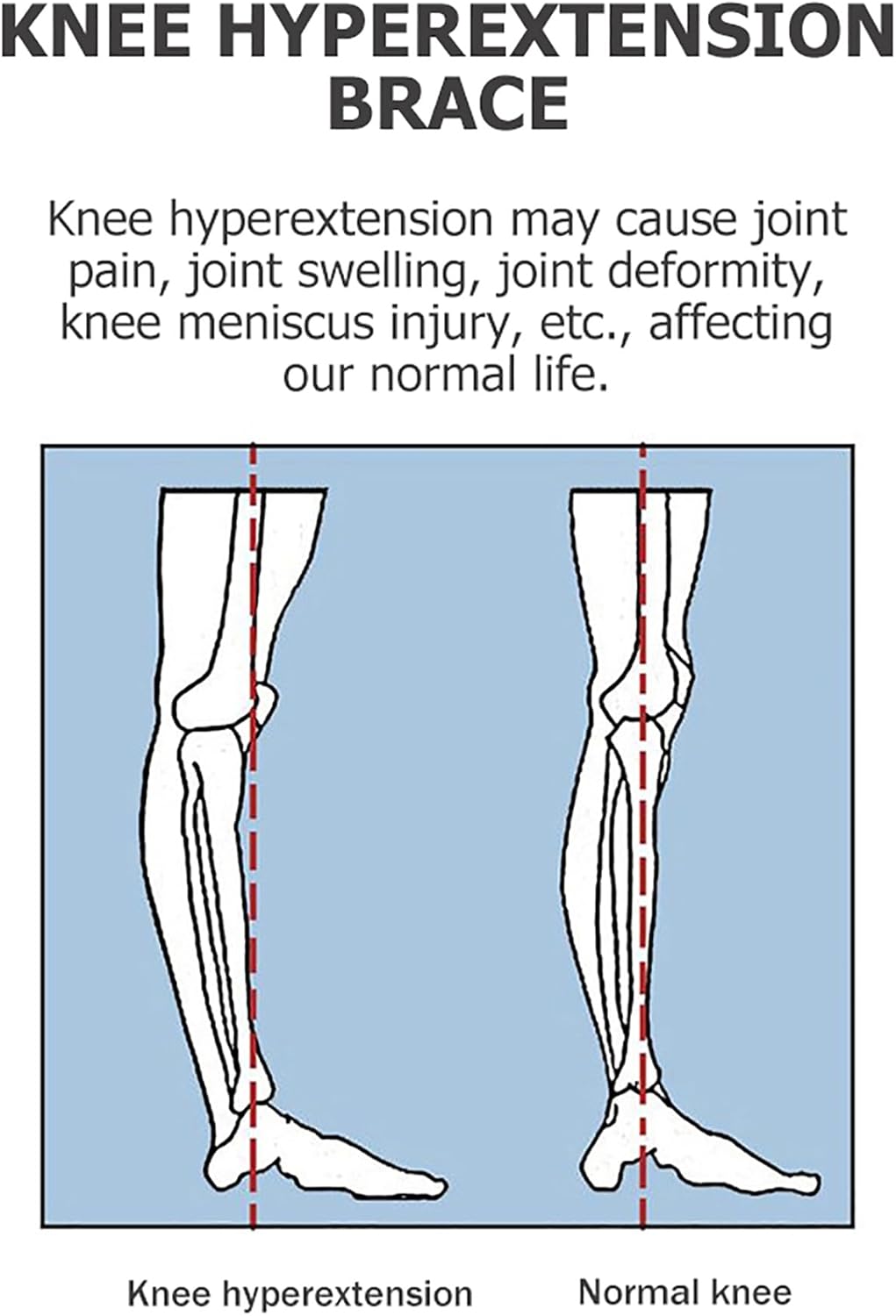 Knee Support, Knee with Straps, Airbag, Support for Osteoarthritis Meniscus Tear Arthritis Relief, Knee Immobilizer Knee Brace,