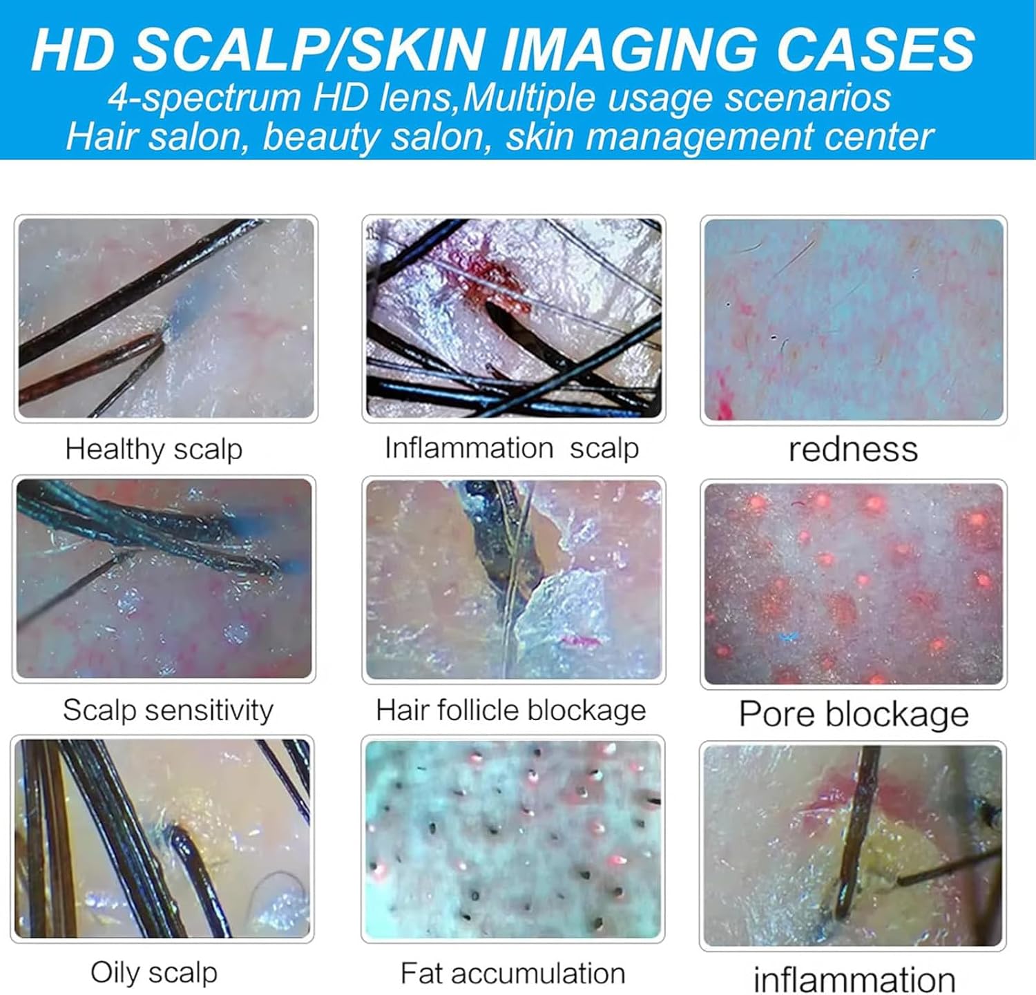 15Inch Multi-Functional Hair Follicle Skin Analyser, 70x/200x Scalp Detector Machine for Home & Salon Use, Professional Hair & Scalp Health Monitor