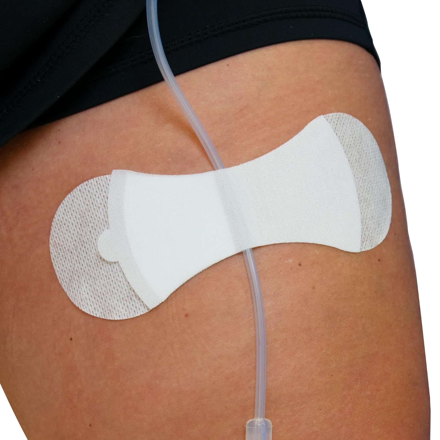 TIDI 3400L Grip-Lok Large Securement Device ― Pack of 100 ― Catheter Stabilization Device ― White ― Flexible Material ― Low-Profile Design for Comfort― Home Healthcare ― FSA Eligible Medical Supplies