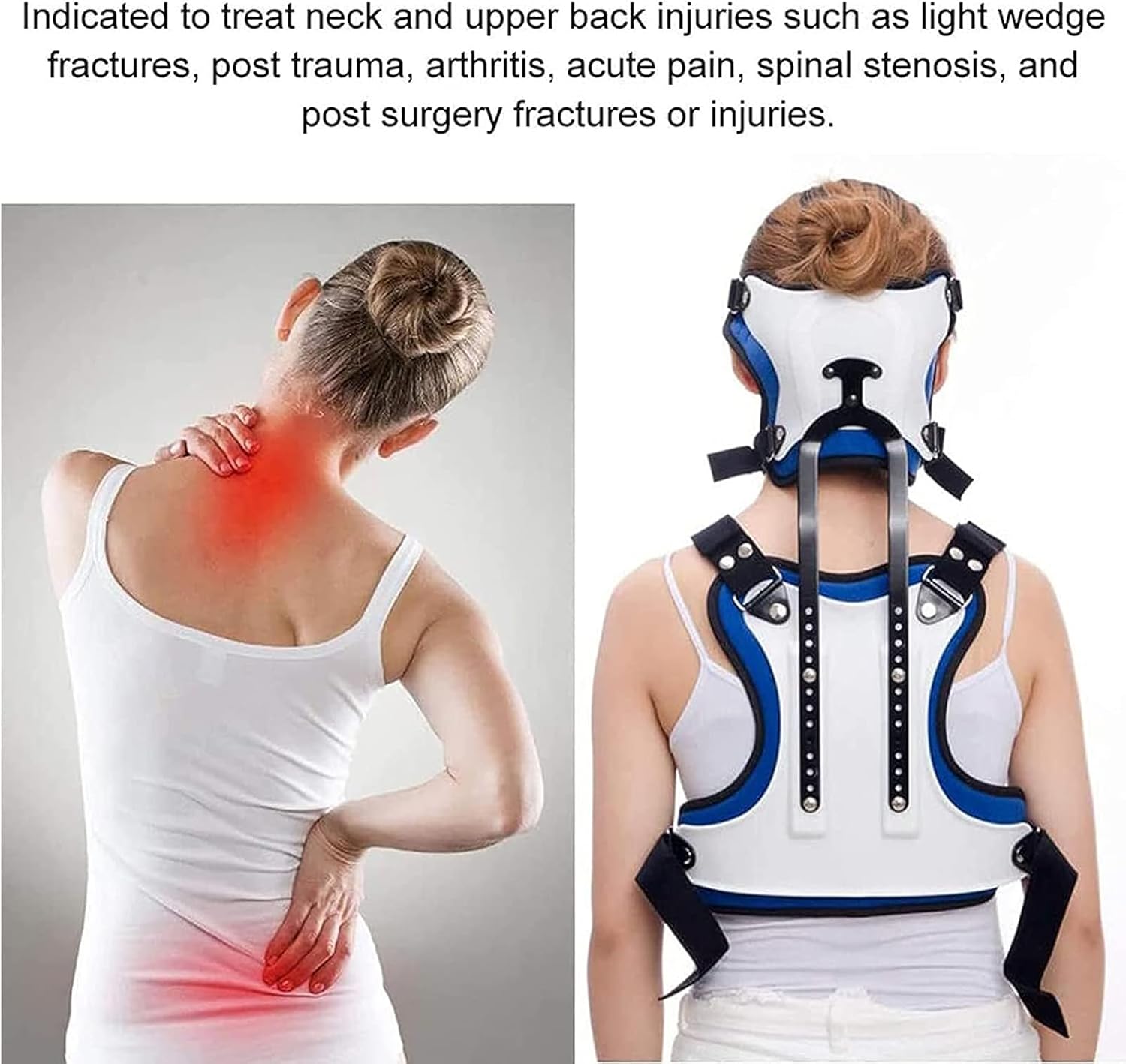 Adjustable Cervical Thoracic Brace, Lumbar Back Spine Orthosis, Neck Chest Fixation Brace Thoracic Orthosis, for Compression Fractures and Osteoporosis,