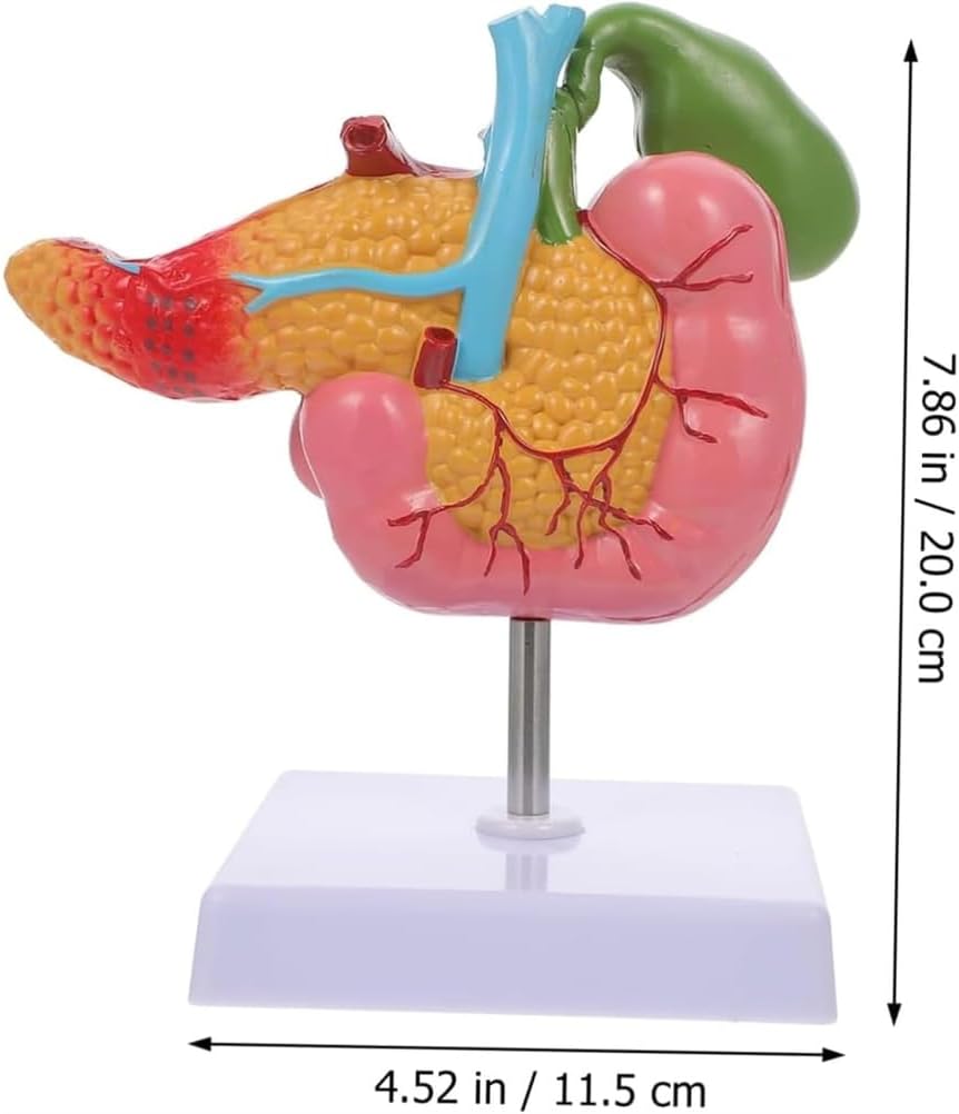 Hepatobiliary Pancreas Model with Gallstones - Gallbladder Surgery Training Kit - Medical School Teaching Aid for Gastroenterology