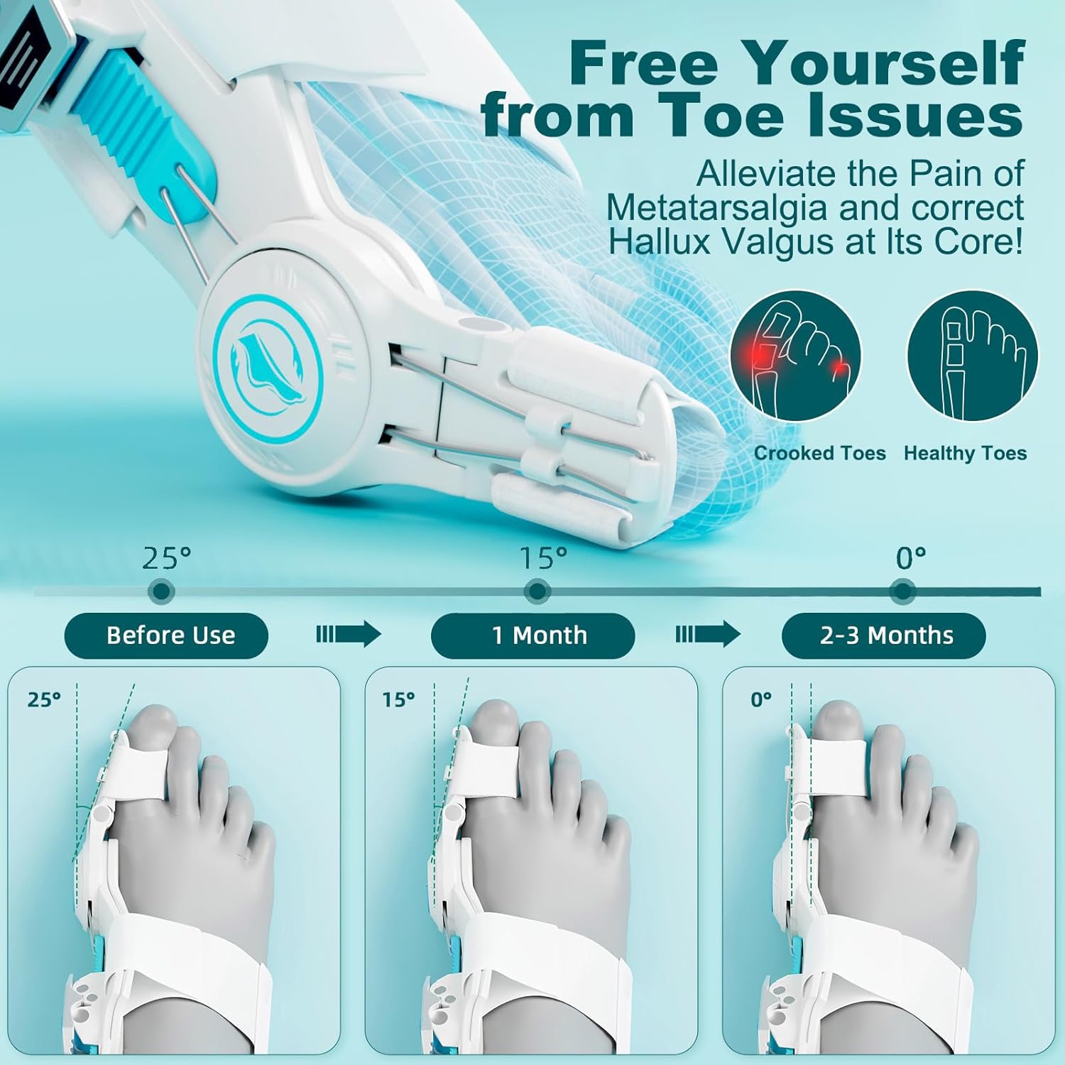 Upgraded Bunion Corrector for Women & Men, Orthopedic Bunions Correction with Non Slip Big Toe Separators, Adjustable Bunion Splint Suitable for Left/Right Feet Bunion Relief, 2PCS
