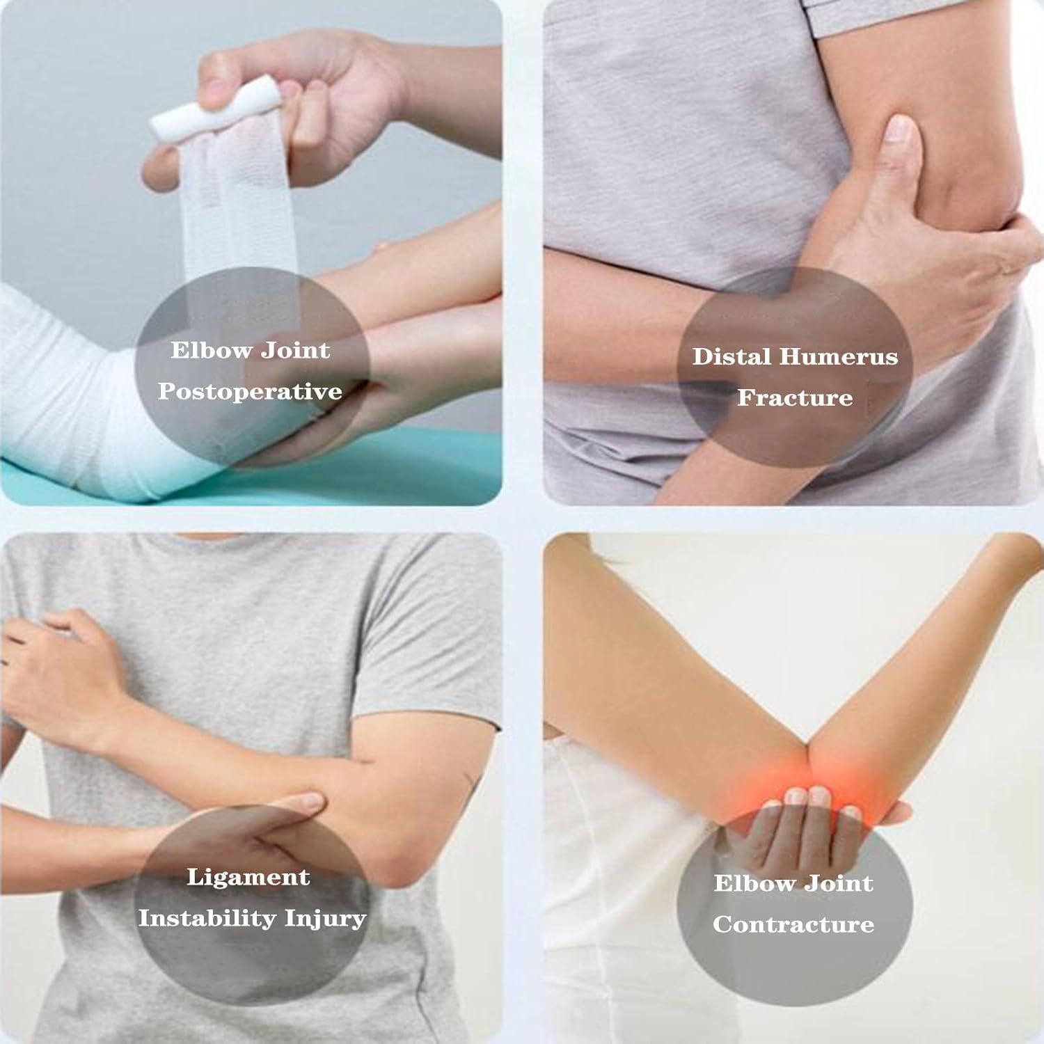SFKLYU Hinged Elbow Brace Adjustable Post Elbow Brace Arm Splint Supporting from for Postoperative Arm Injury Recovery, Ligament and Tendon Repairs,Left