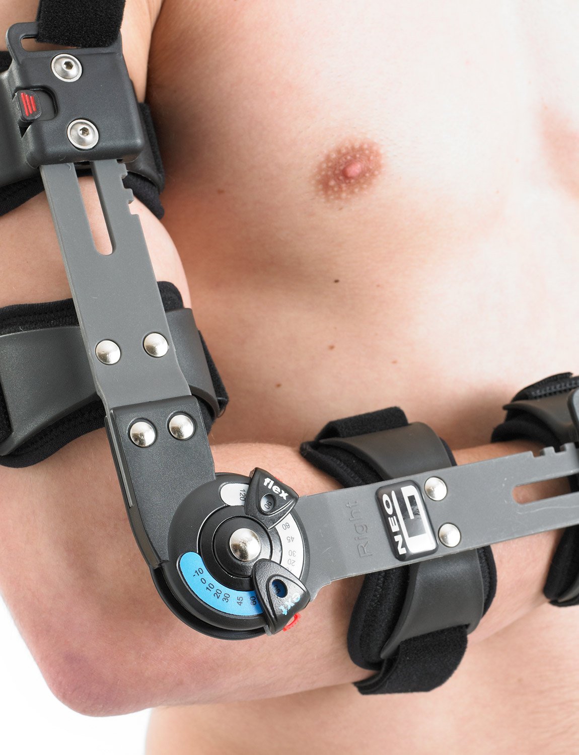 Neo-G Post-Operative Elbow Brace – For Ligament Injuries, Pre/Post Surgery, Joint Protection & Stability, Rehabilitation, Arthritic & Meniscus Pain - Class 1 Medical Device – Left – Black – Unisex