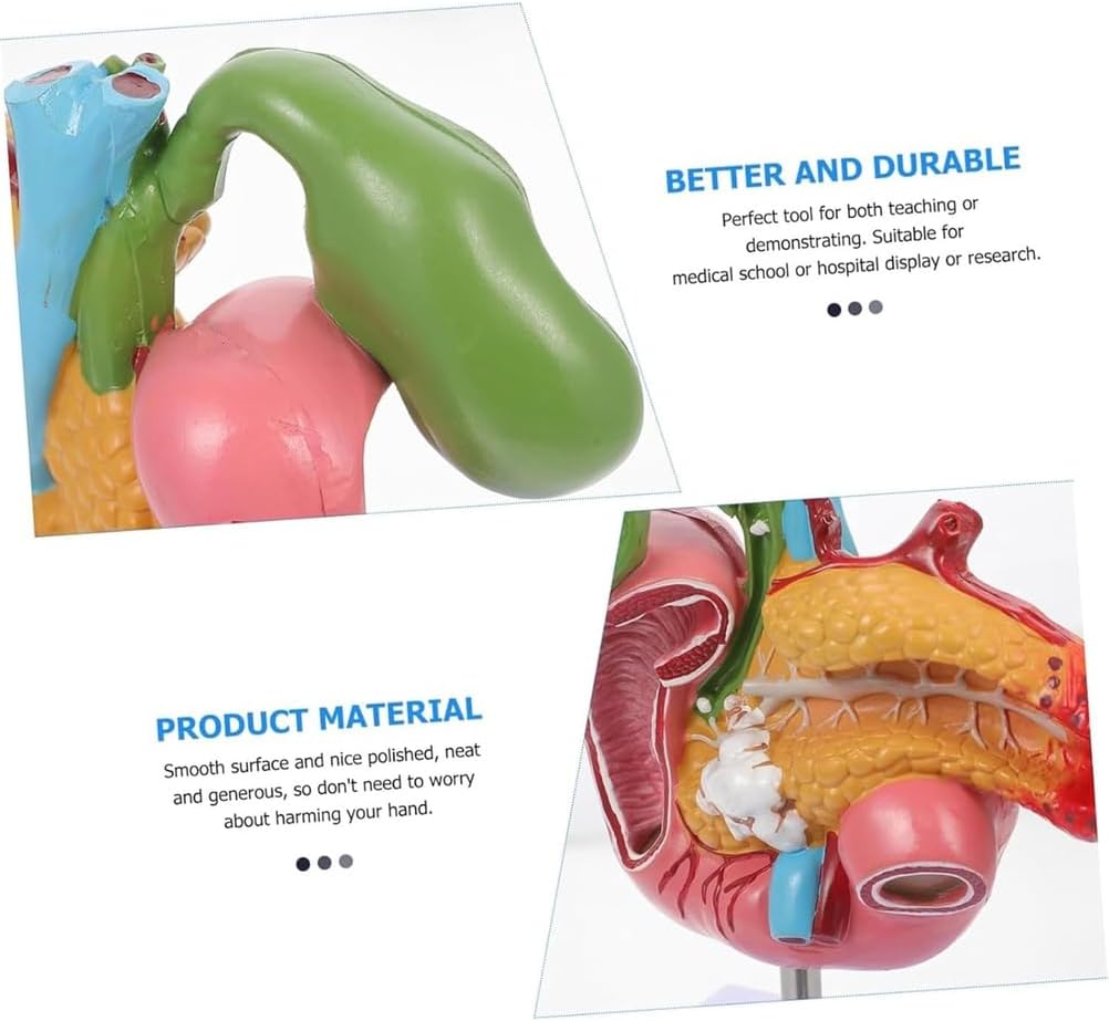 Hepatobiliary Pancreas Model with Gallstones - Gallbladder Surgery Training Kit - Medical School Teaching Aid for Gastroenterology