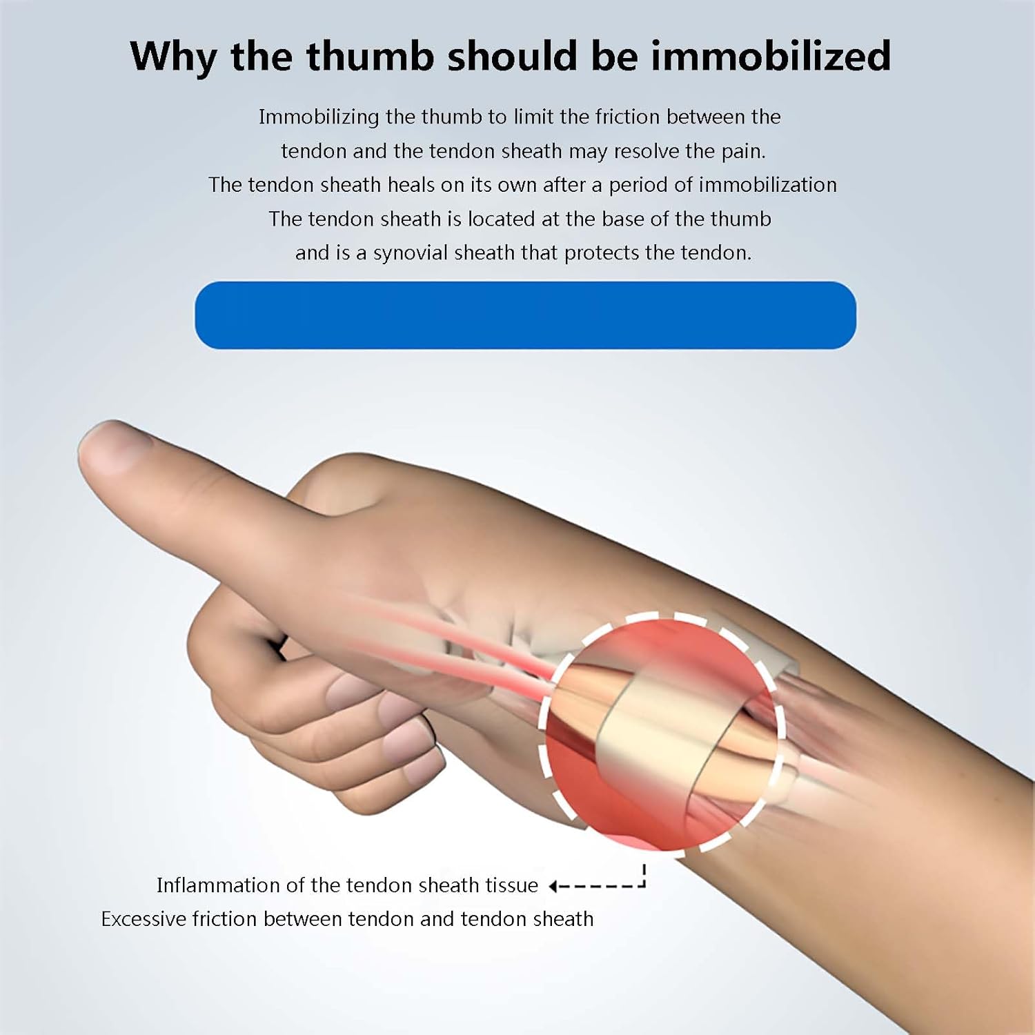 HAILM Thumb Brace with Metal Splints, Breathable Wrist Brace Carpal Tunnel, Fits Men and Women, Help Relieve Joint Pain, Arthritis, Tendonitis, Wrist Fractures/Sprain,Left hand,S