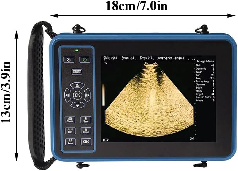 DAWEI Veterinary Ultrasound Machine for Pregnancy Portable Scanner with 3.5Mhz Convex Probe Waterproof Probe for Pig,Sheep,Dog,Cat,Livestock,Pet use
