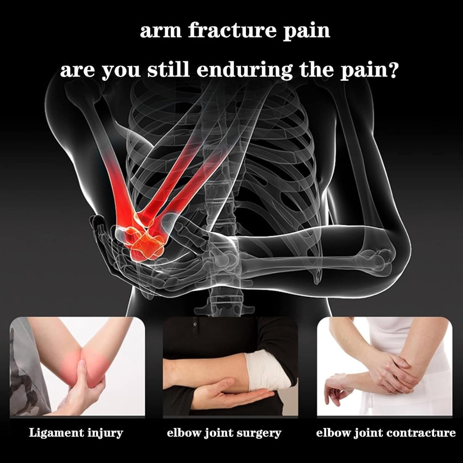 Elbow Stabilizer Splint Adjustable Rom's Postoperative Elbow Brace Stabilizer Relieve Joint Contracture Fixation Pain for Elbow Fracture Fixation