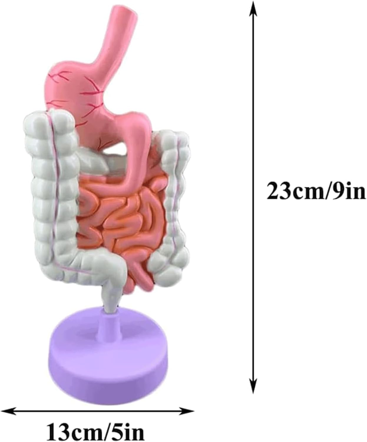 Large Intestine Pathological Model Pathological Anatomy Teaching Model Human Organ Model for Teaching Study Class Students