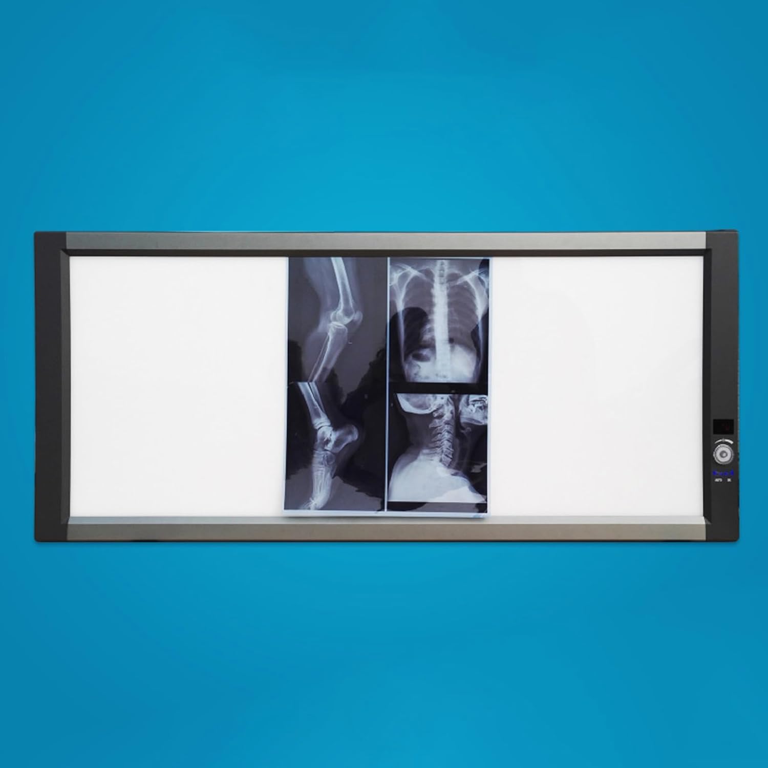 Portable X-Ray LED Film Viewer, 0-100% Adjustable Brightness, Wall Mounting View Box, Medical Imaging for Home, Hospital and Lab Use(50x120x2.5cm/20x47x1in)