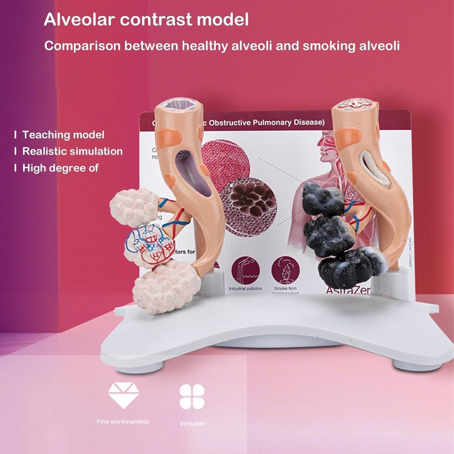 Human Alveolar Anatomical Model, Smoking Alveoli and Healthy Alveoli Comparison Model, Enlarged Alveolar Structure Model, with English Back Card, for Health Teaching