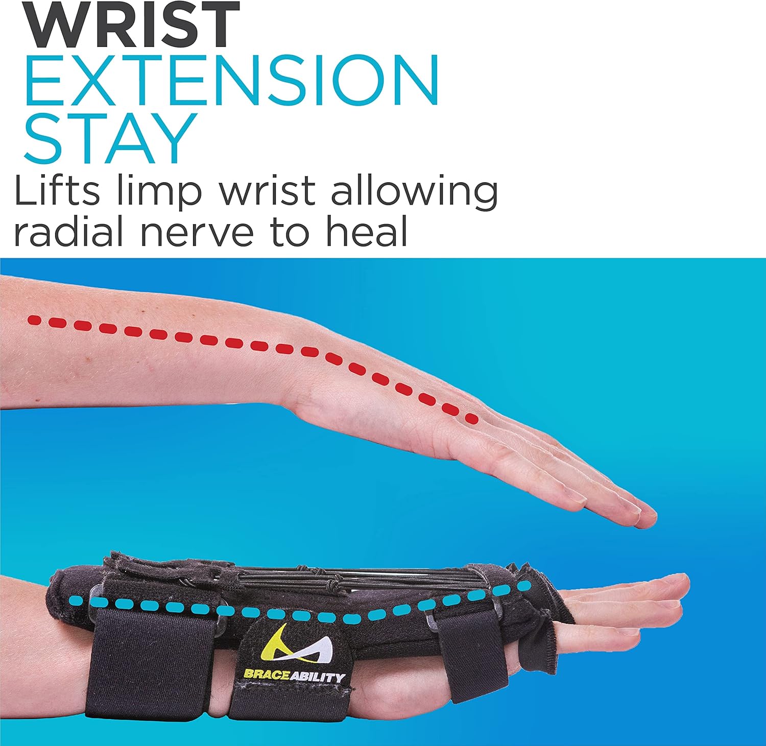 BraceAbility Radial Nerve Palsy Splint - Dynamic Wrist Drop Splint for Limp Finger Wrist Extension, Saturday Night, Honeymoon, Crutch Palsy, Stroke Recovery Brace - Fits Right or Left Hand (One Size)