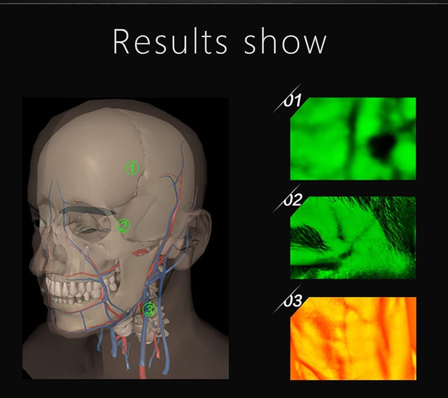 Adults Children Suitable Vein Viewer Display Lights Imaging Find Vein Medical Vein Finder Vein Viewer, for Hospitals