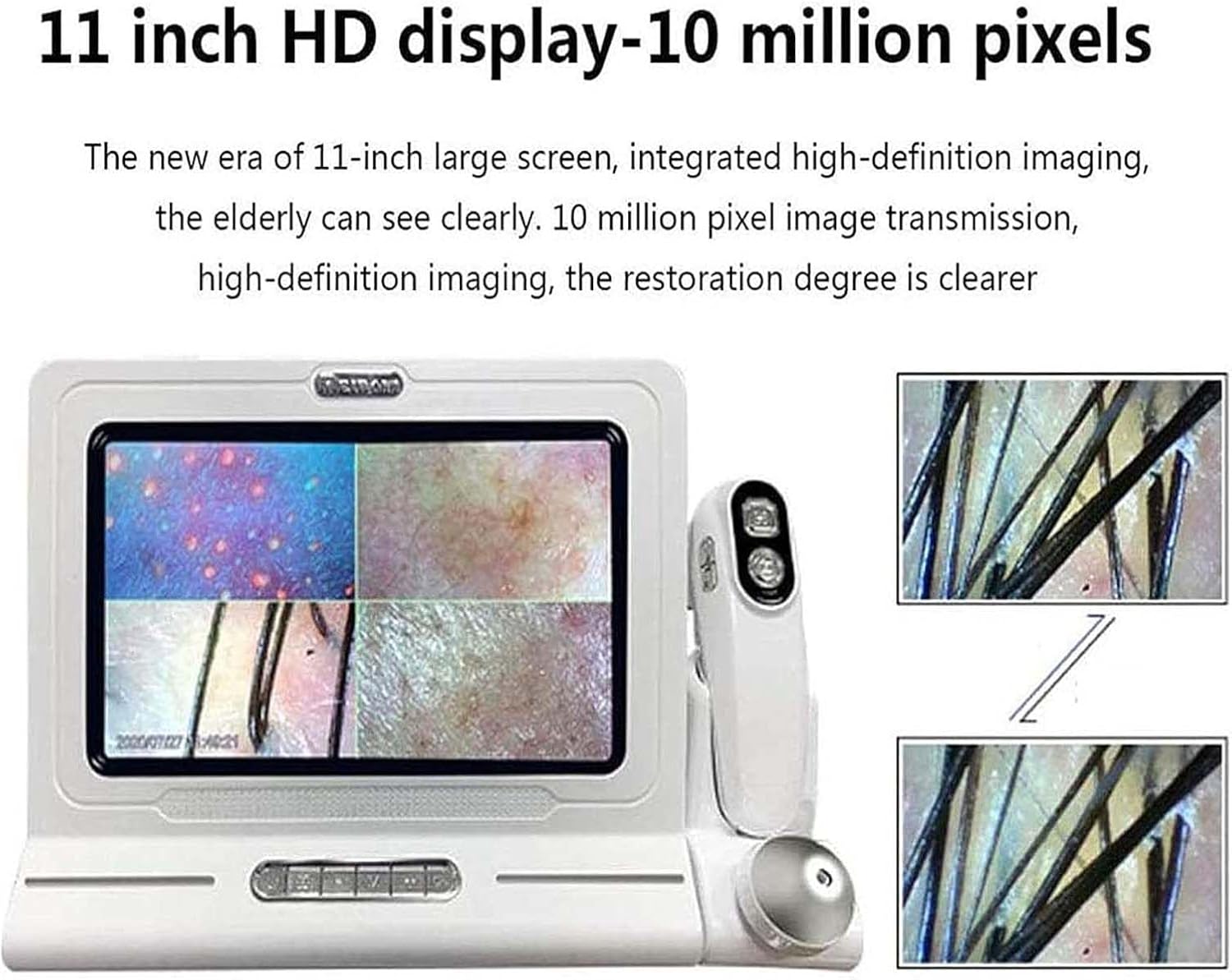 Skin Diagnosis Hair Analyzer Machine,50x/200x Skin Hair Scalp Detector,11-Inch Hd Display-10 Million Pixels,for Facial,Hairdressing,Scalp Care,Home,Beauty Salon