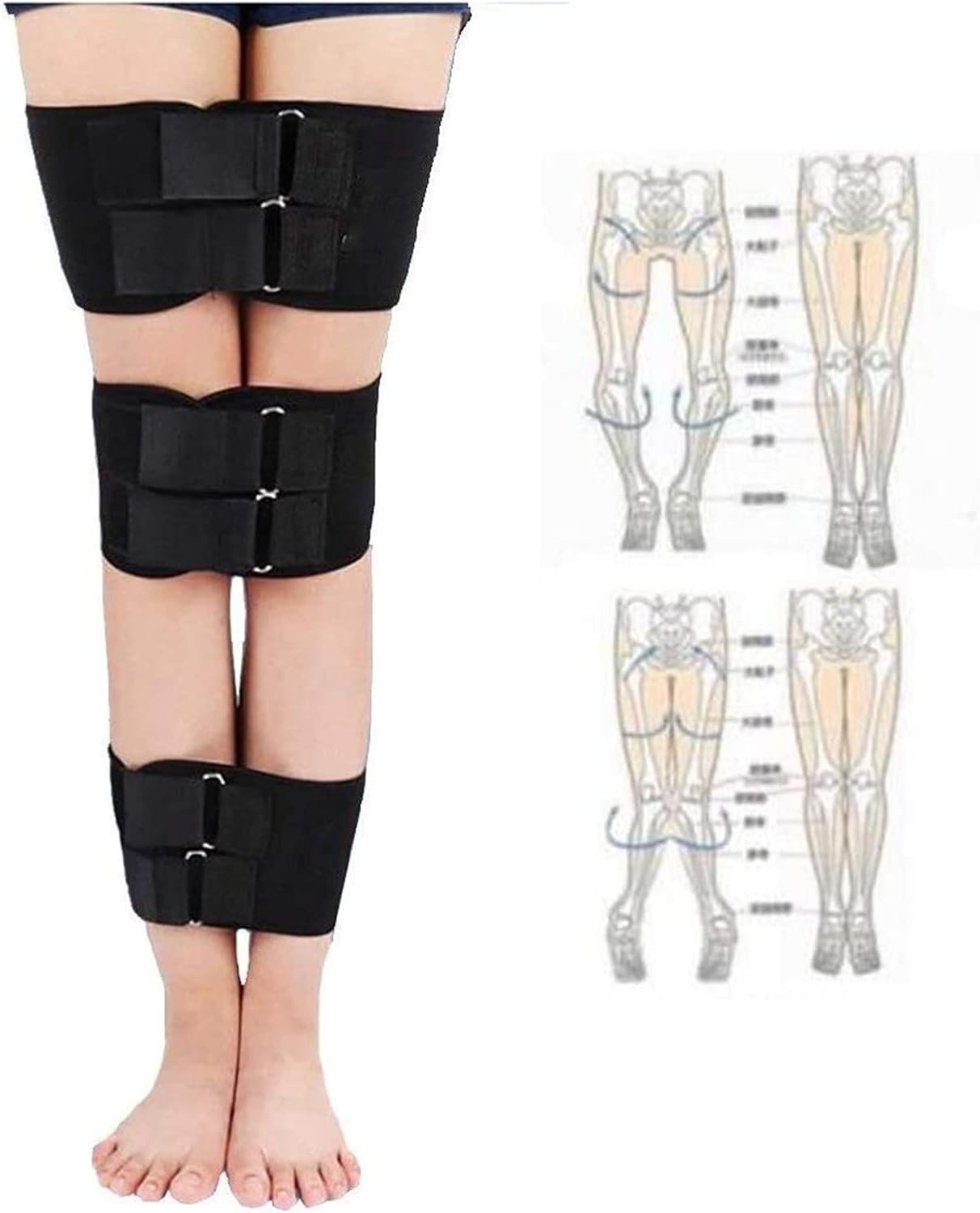 Legs Correction Belt O Type Legs X Type Leg Straightening Band Bandage Posture Corrector Used for Men Women and Children,