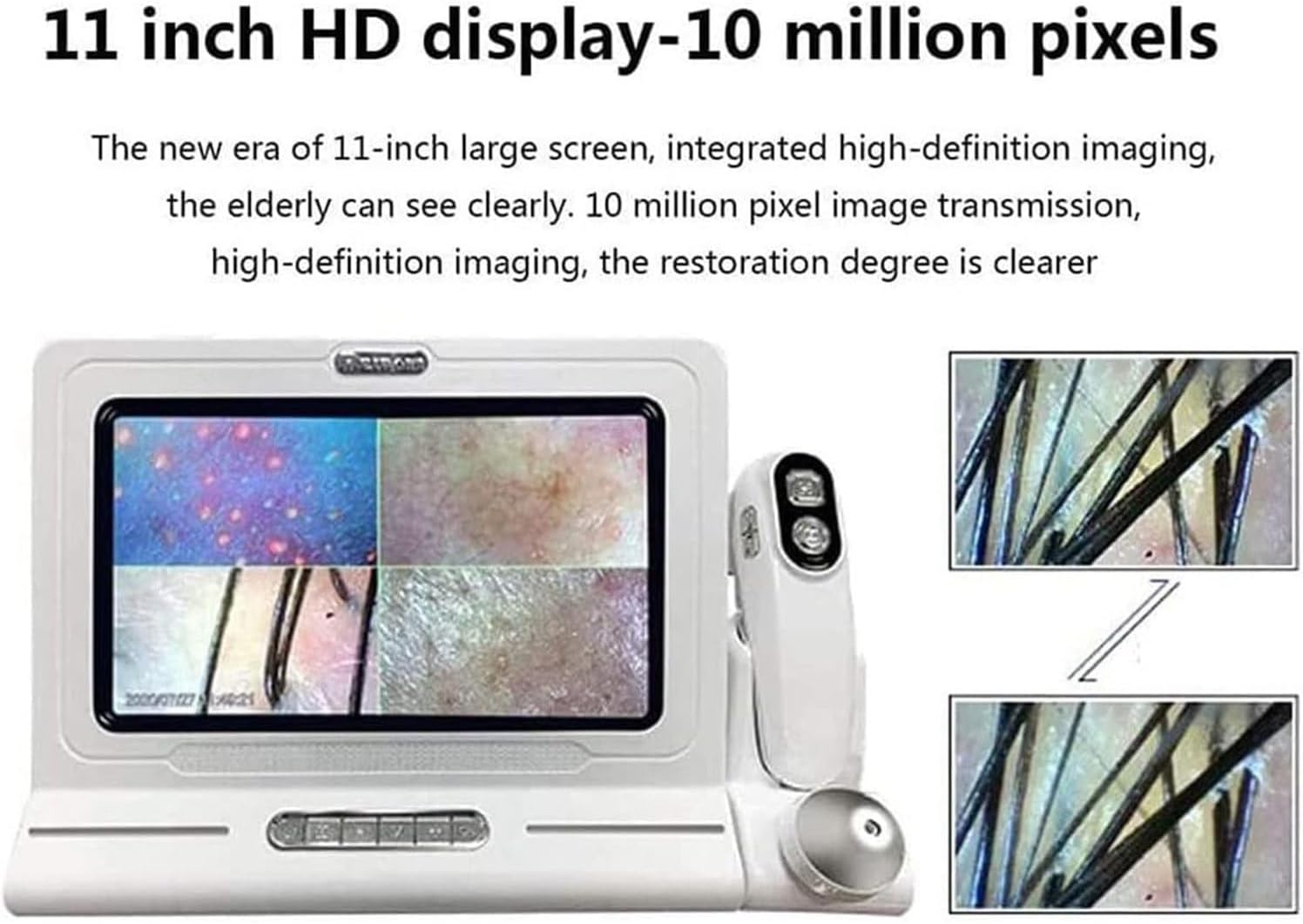 11 Inches Skin Diagnosis Hair Analyzer Machine with HD LCD Screen Digital Skin Detector Moisture Tester, Four-Picture Comparison & 16G Storage for Home Spa Salon Use