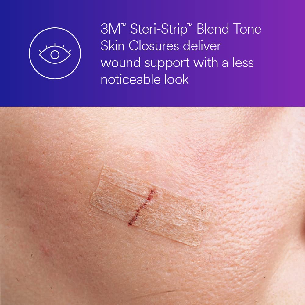 3M™ Steri-Strip™ Blend Tone Skin Closures, B1551, 1/4 in x 3 in, 50 Bag/Carton, 4 Carton/Case