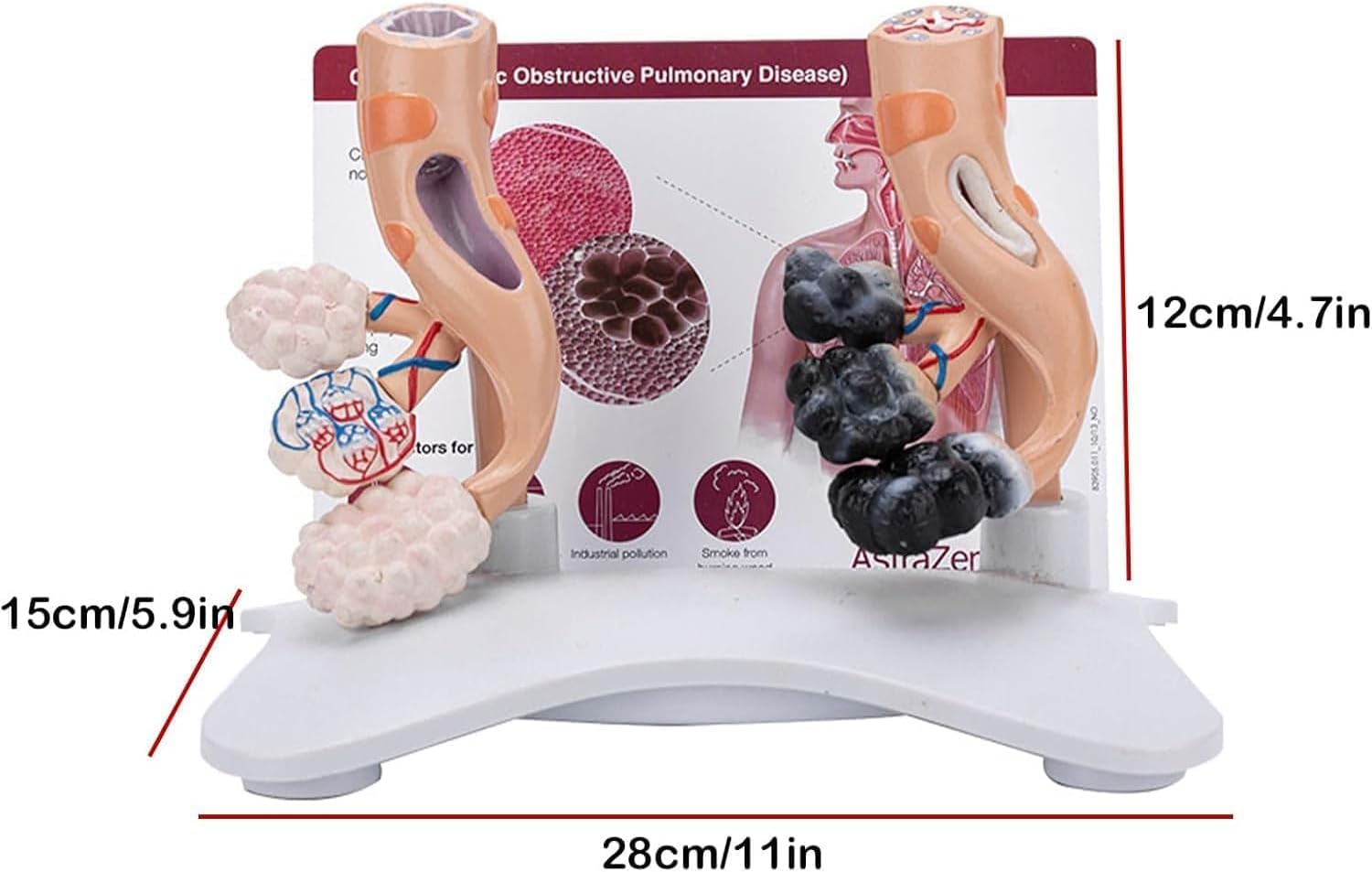 Human Alveolar Anatomical Model, Smoking Alveoli and Healthy Alveoli Comparison Model, Enlarged Alveolar Structure Model, with English Back Card, for Health Teaching