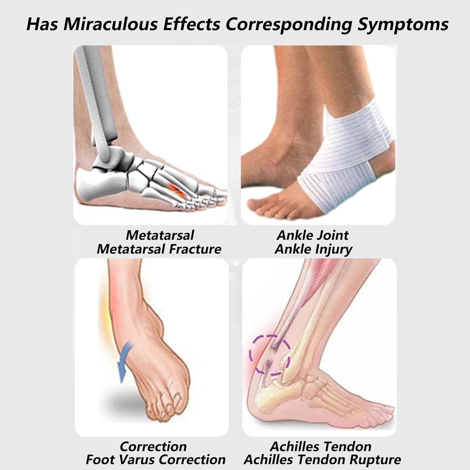 SFKLYU Plantar Fasciitis Stretch Splint Soft Leg Brace Support Adjustable Leg Support Brace Orthopedic Sleeping Immobilizer Stretch Boot for Achilles Tendonitis, Foot Pain,S