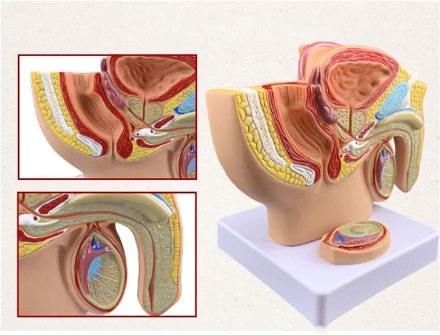 Male Pelvis sagittal Anatomy reproductive Organs Prostate Model, Used for Medical Teaching Auxiliary Tools and Male Doctor-Patient Communication