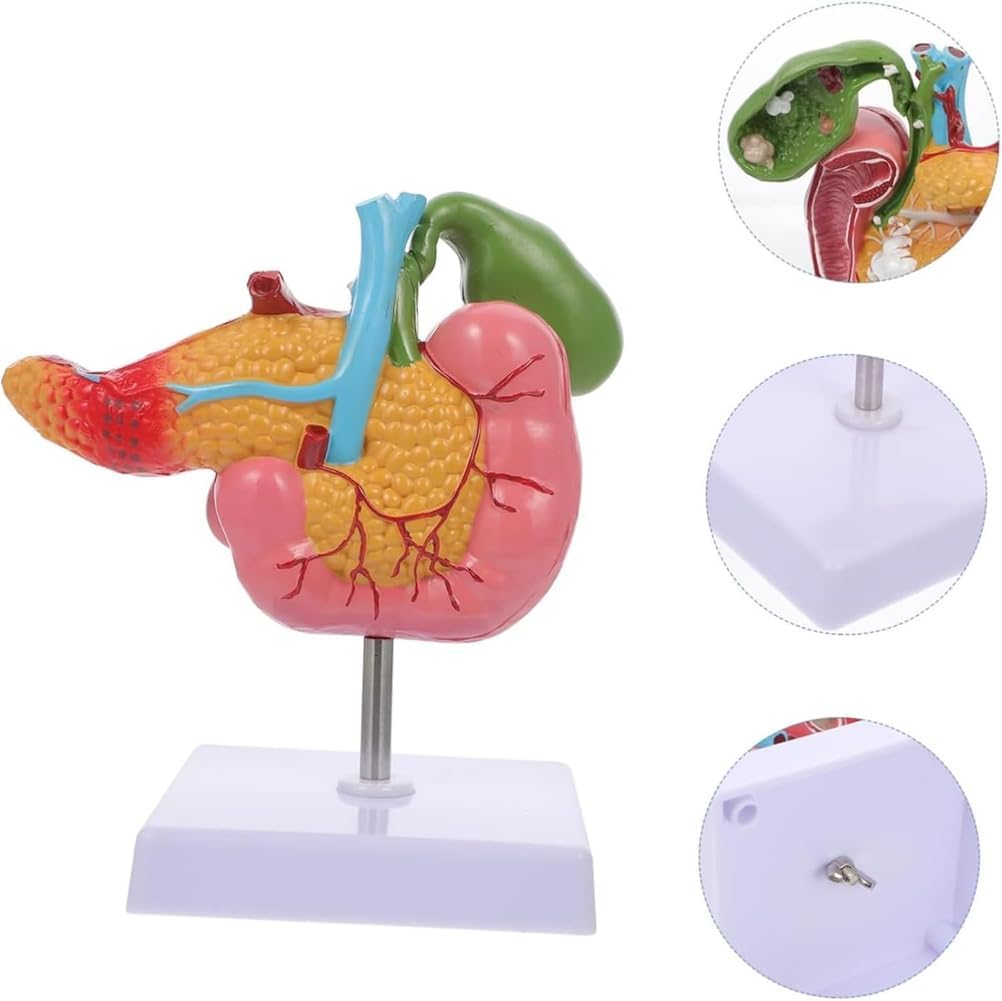 Hepatobiliary Pancreas Model with Gallstones - Gallbladder Surgery Training Kit - Medical School Teaching Aid for Gastroenterology