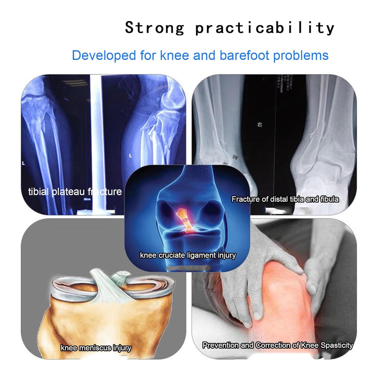 VIDECOR Knee Brace Immobilizer Brace Knee Ankle Foot Orthosis Hip Abduction Orthosis Adjustable Fixed Limb Orthosis Before and After Surgery Splint Post Op Immobiliser,rightL