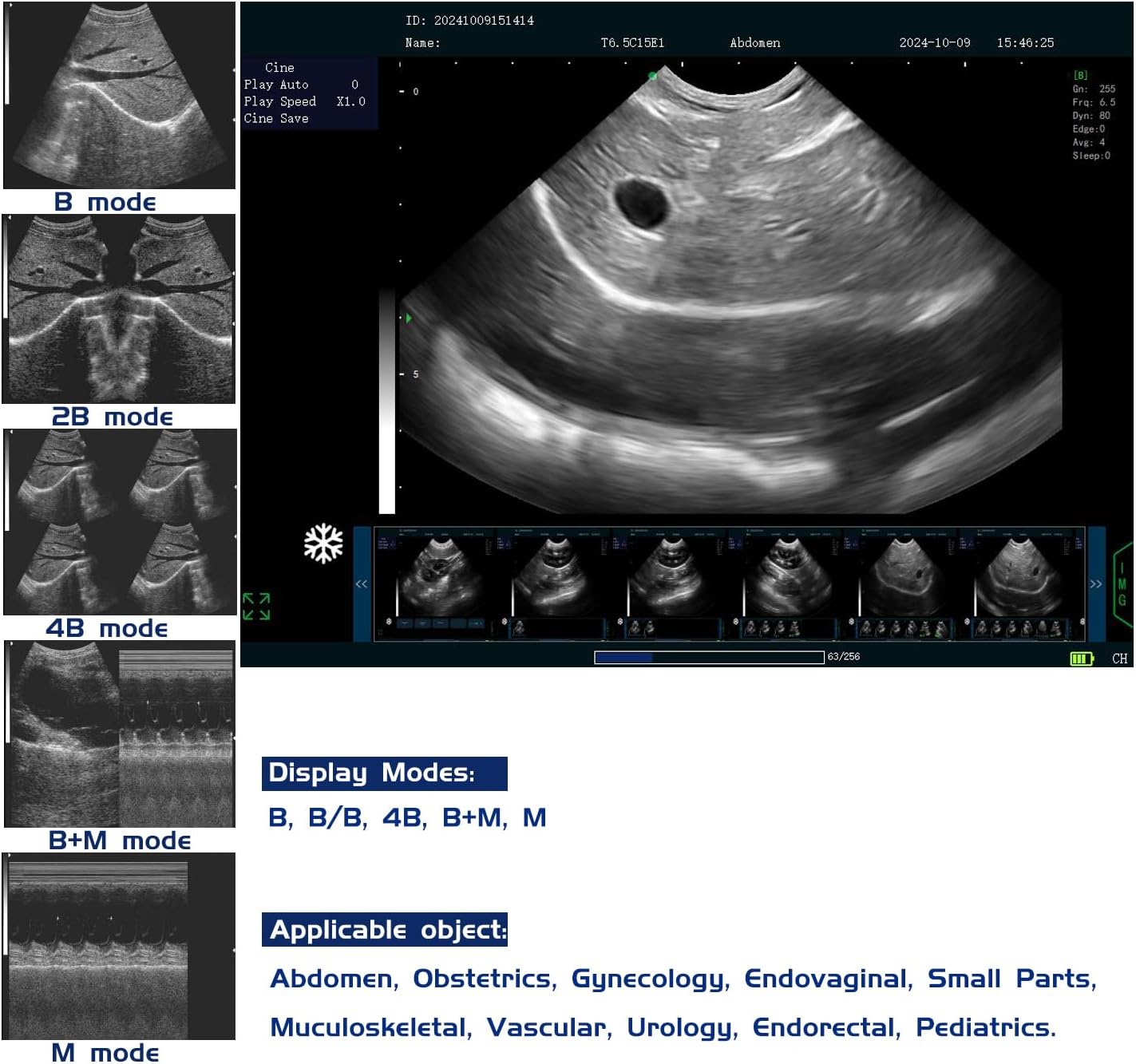 N60 Ultrasound Machine, PW upgradable, 15