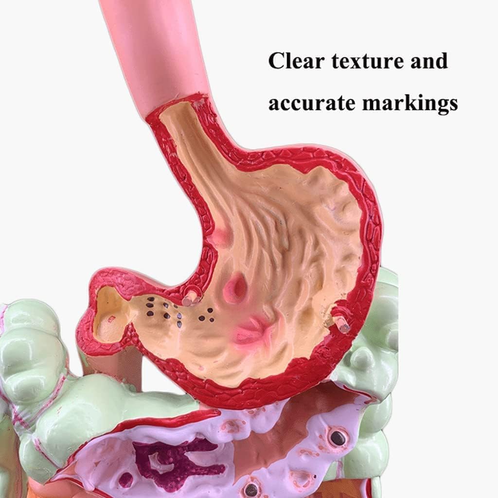 Large Intestine Pathological Model Pathological Anatomy Teaching Model Human Organ Model for Teaching Study Class Students