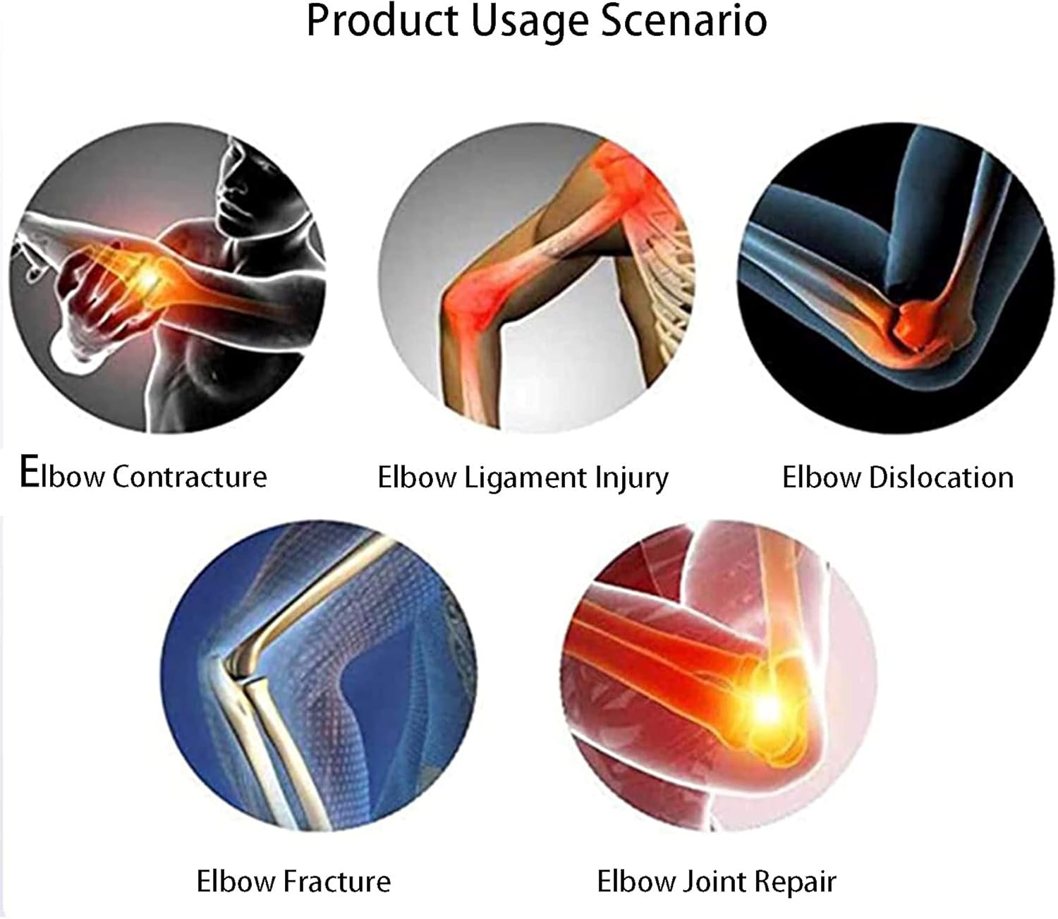 ROM Elbow Brace Adjustable Post Op Elbow Brace ​stabilizer Splint Arm Injury Recovery Support After Surgery for Dislocated Arm Men Women Sports Surgery Injury Recovery Pain Relief,Left